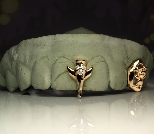 Diamond Encrusted Grillz
